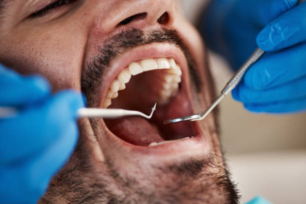 Best Emergency Dental Filling Replacement  in Moody Af, GA