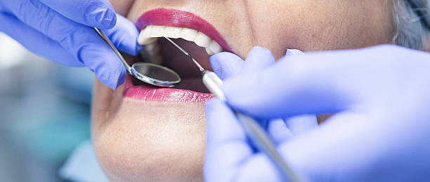 Best Dentist for Tooth Abscess  in Moody Af, GA